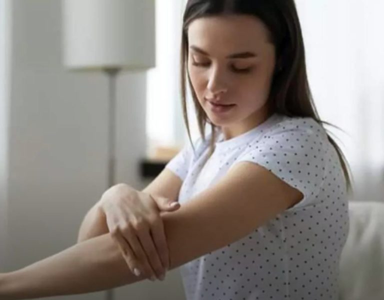 Granos en los brazos
