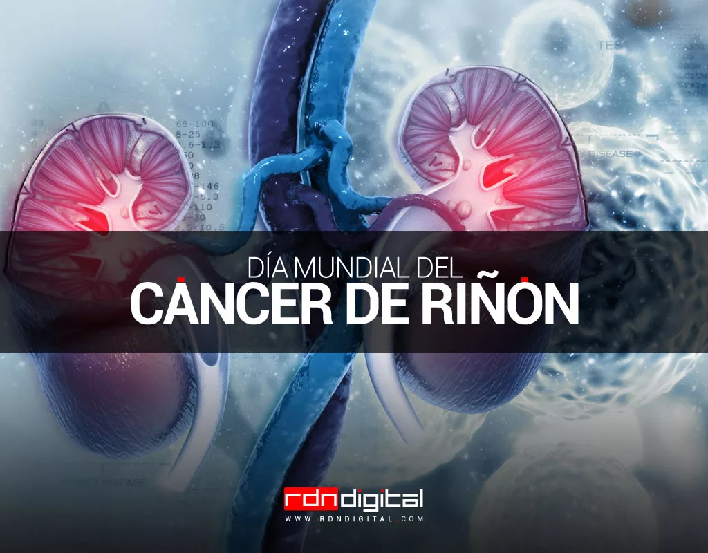 Día Mundial del Cáncer de Riñón