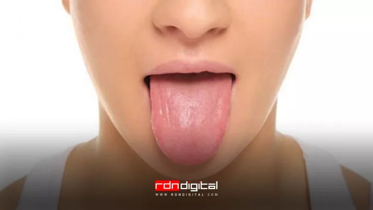 mal aspecto de la lengua