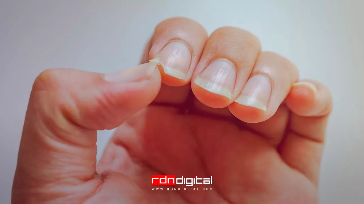 cómo curar las uñas amarillas