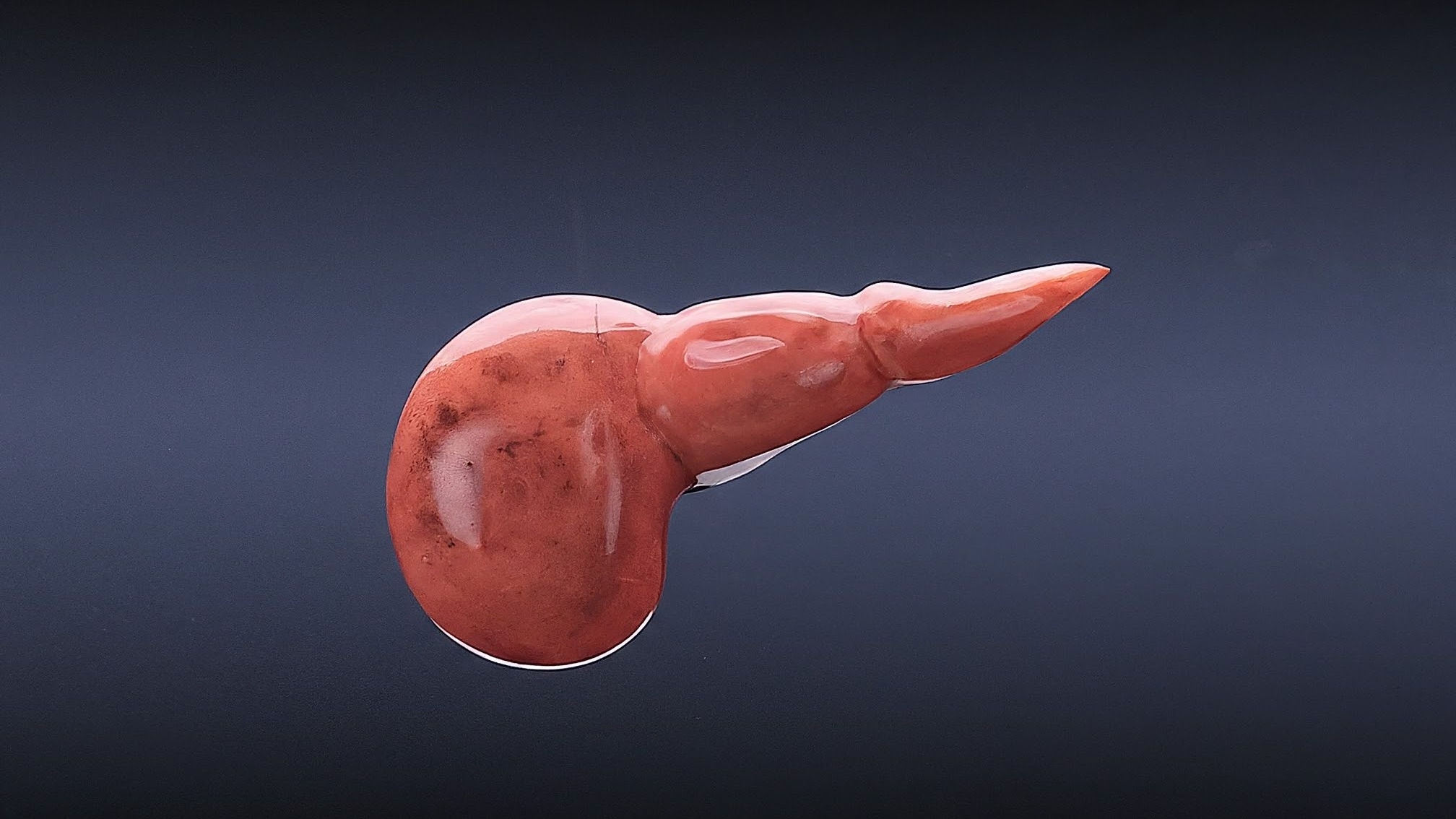 cáncer de páncreas